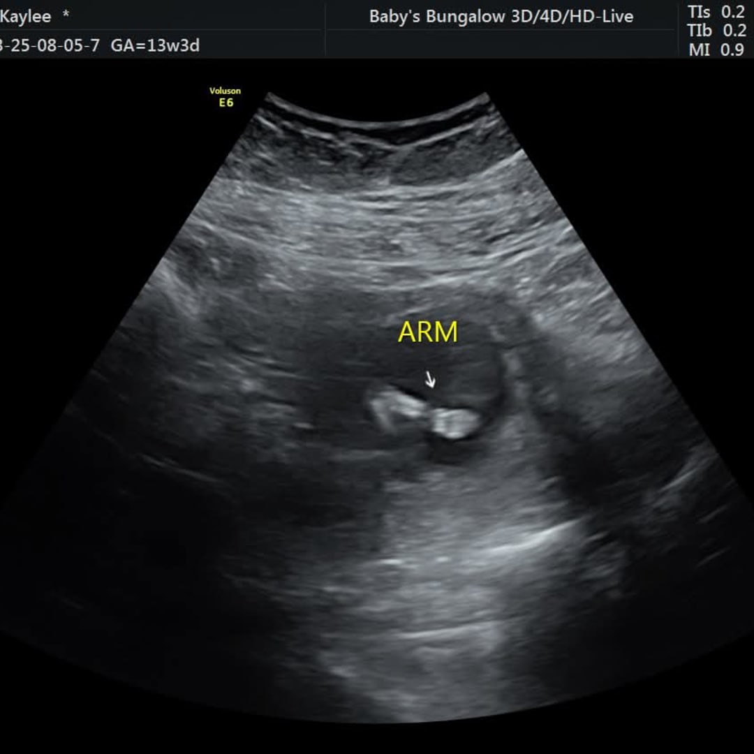 Photo shared by Kaylee for their Babylist baby registry.