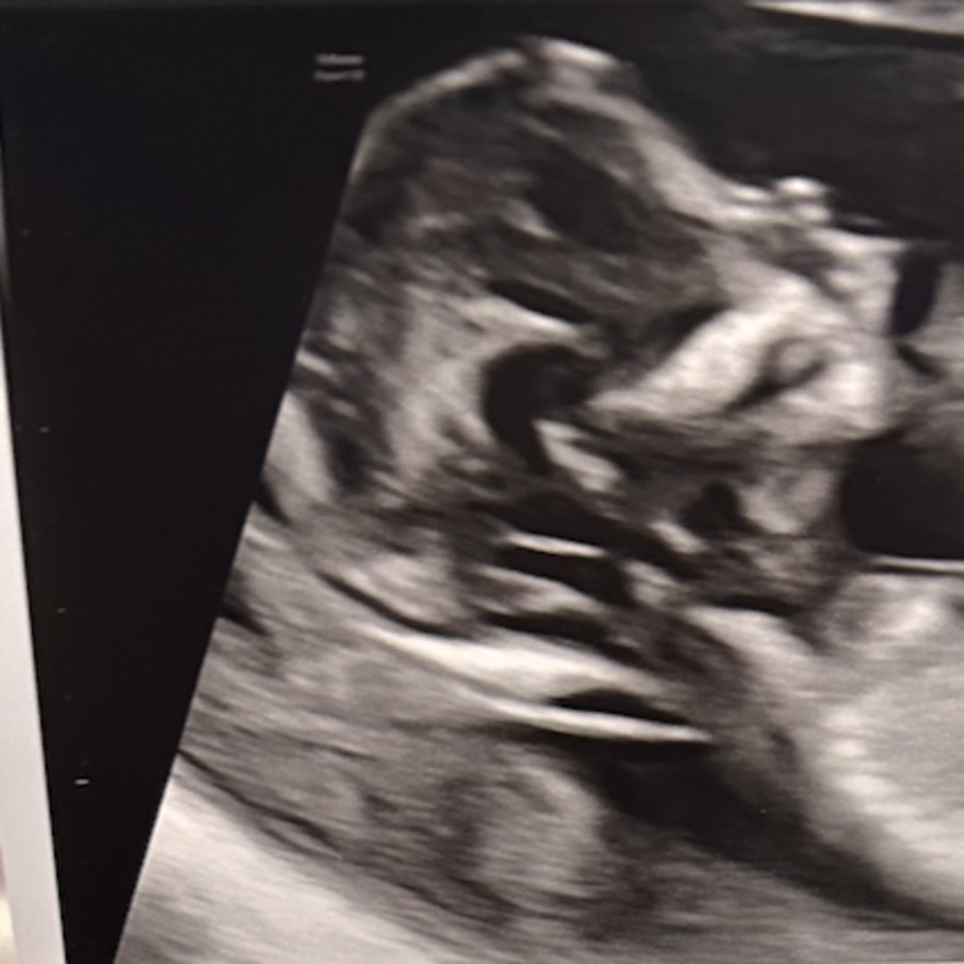 Photo shared by Breanna for their Babylist baby registry.