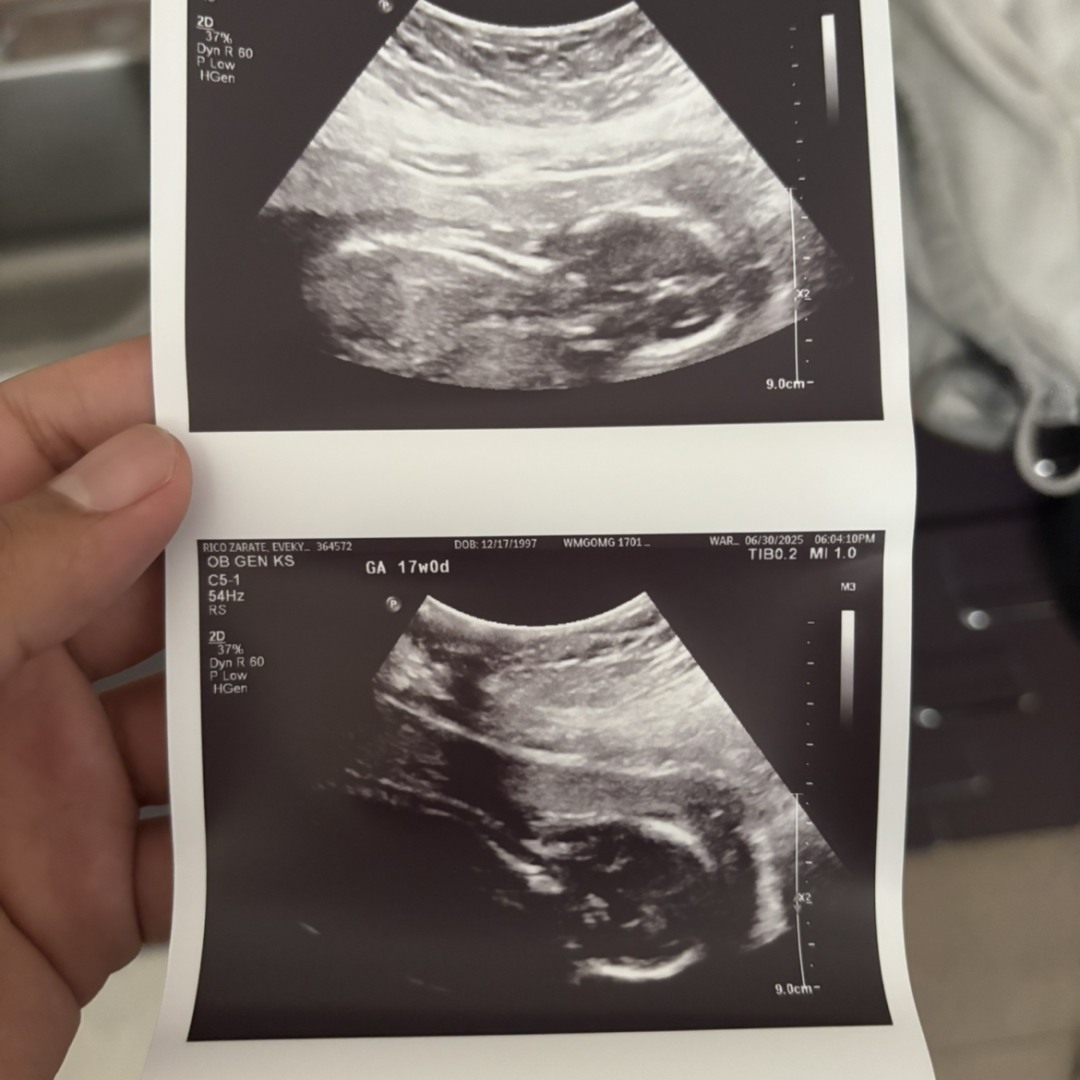 Photo shared by Evelyn for their Babylist baby registry.