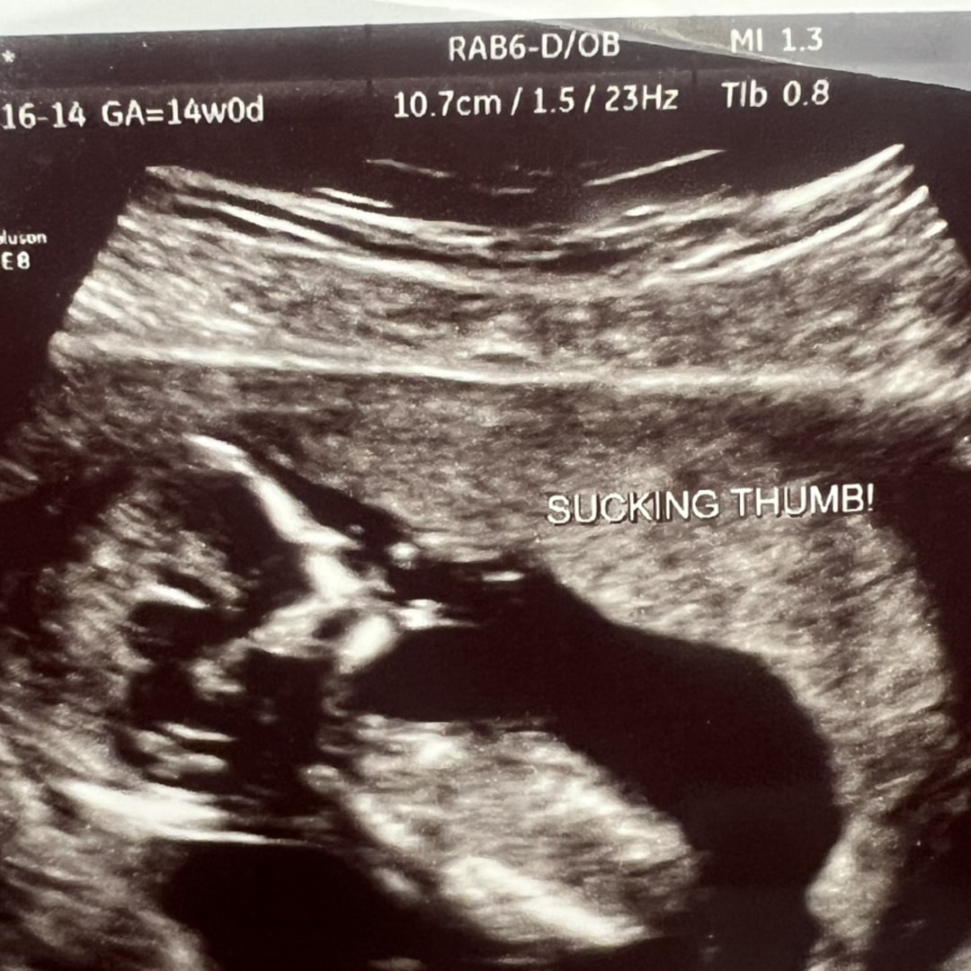 Photo shared by Ella for their Babylist baby registry.