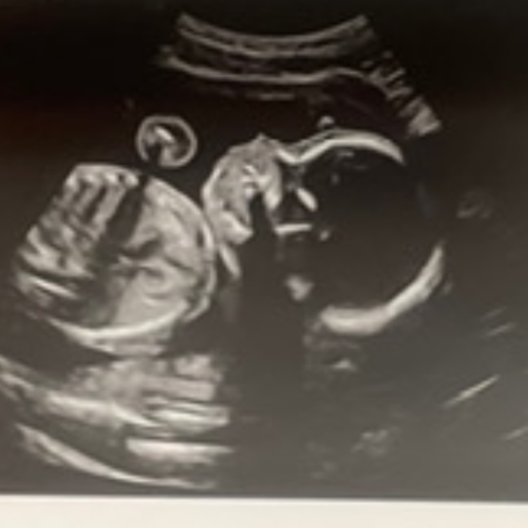 Photo shared by Elianna for their Babylist baby registry.