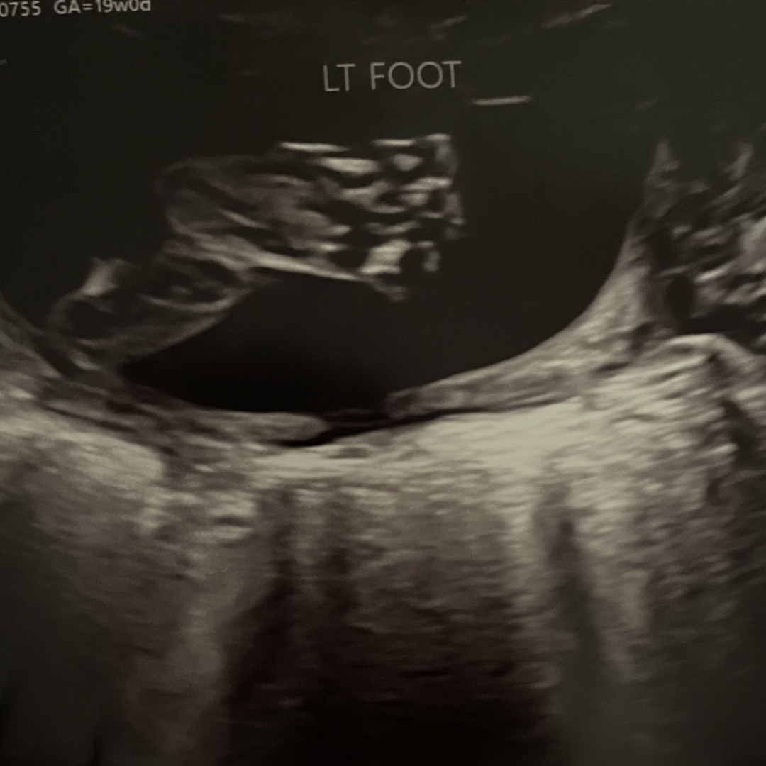 Photo shared by Dayanara for their Babylist baby registry.