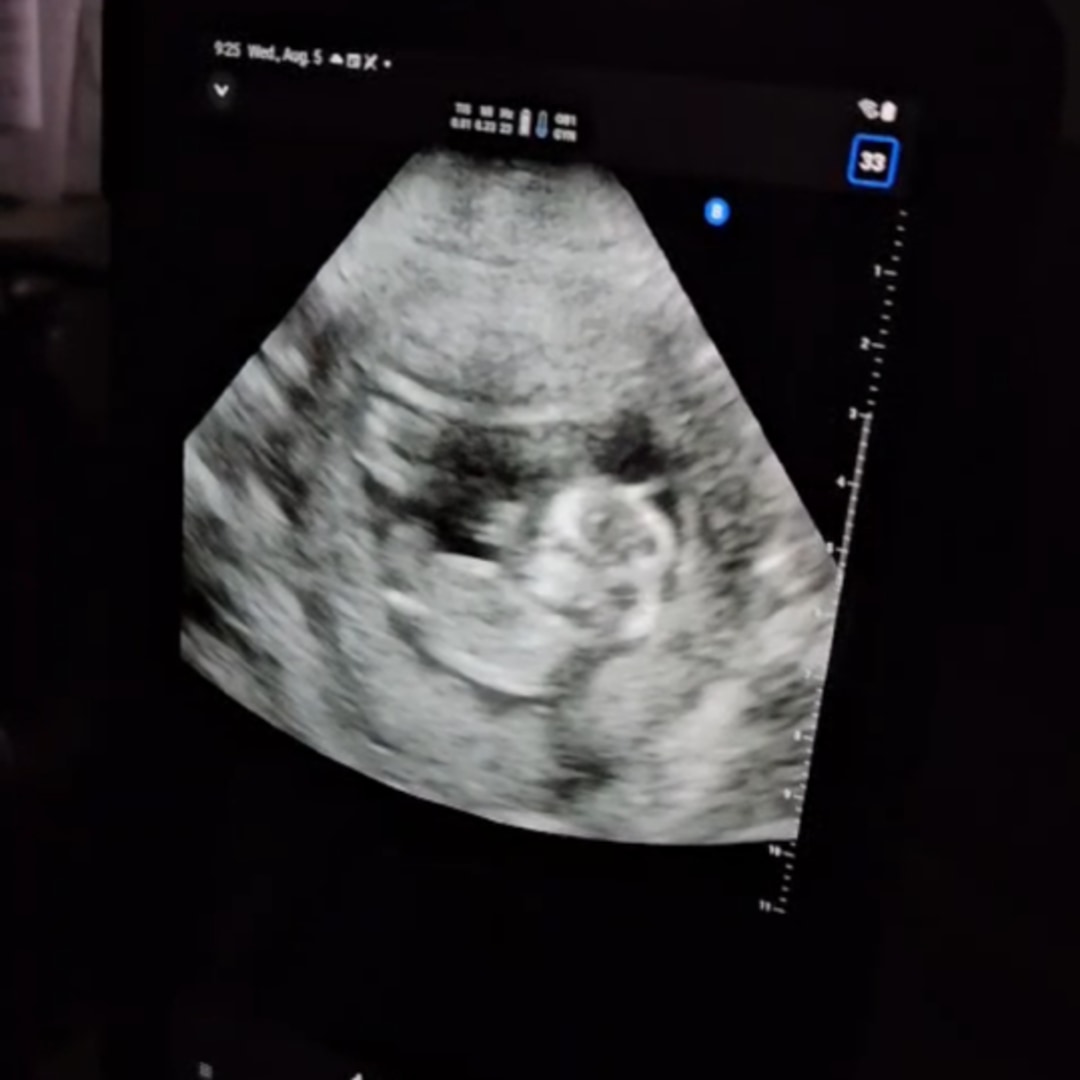Photo shared by Bethany for their Babylist baby registry.