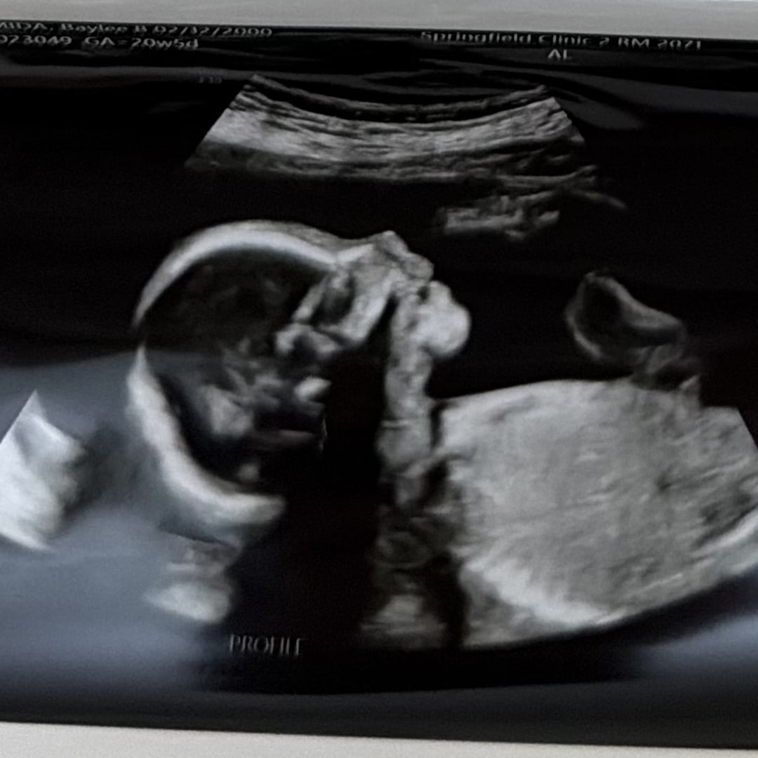 Photo shared by Baylee for their Babylist baby registry.