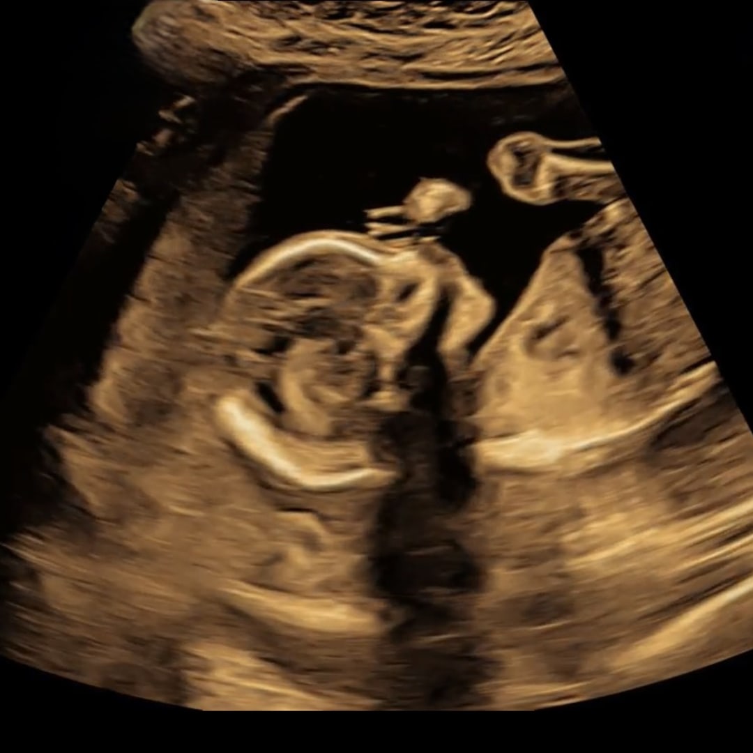 Photo shared by Bailey for their Babylist baby registry.