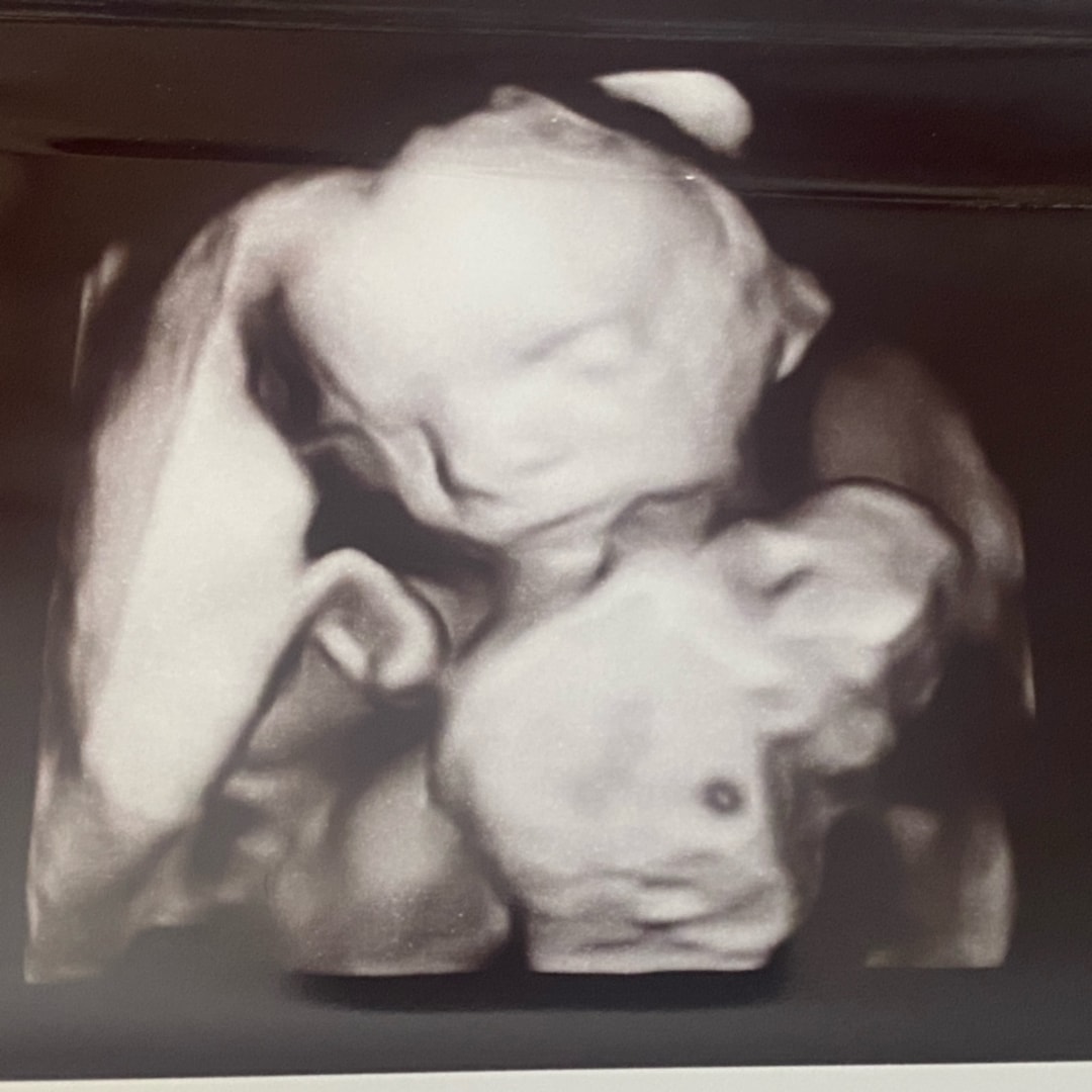 Photo shared by Lindsay for their Babylist baby registry.