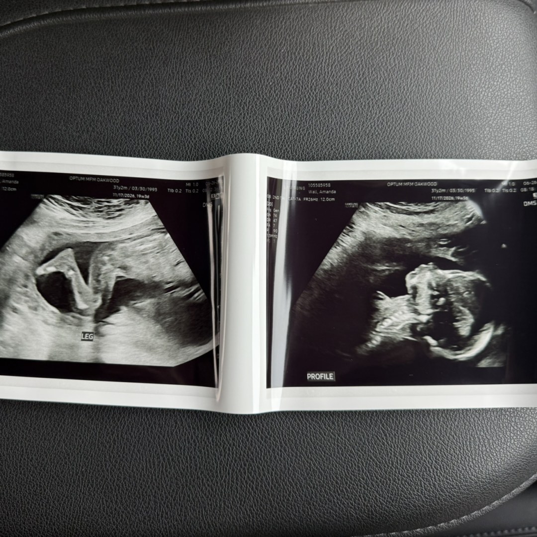 Photo shared by Amanda for their Babylist baby registry.