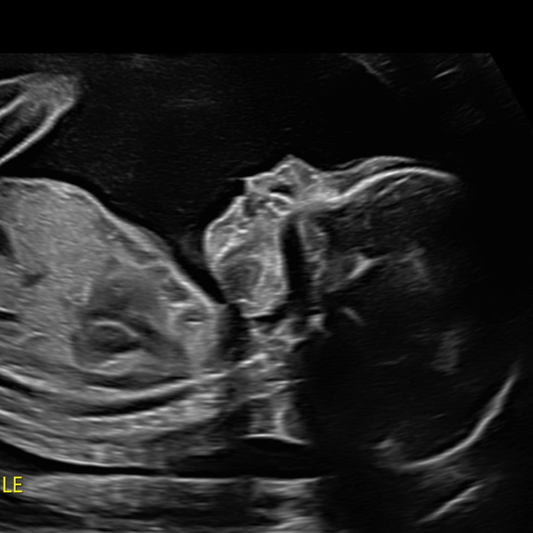 Photo shared by Isabella for their Babylist baby registry.