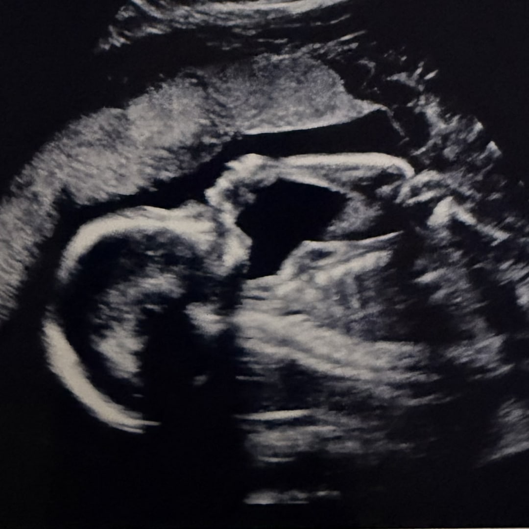Photo shared by Emilie for their Babylist baby registry.