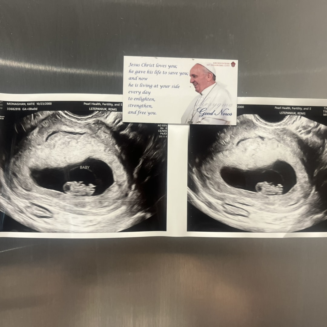 Photo shared by Katie for their Babylist baby registry.