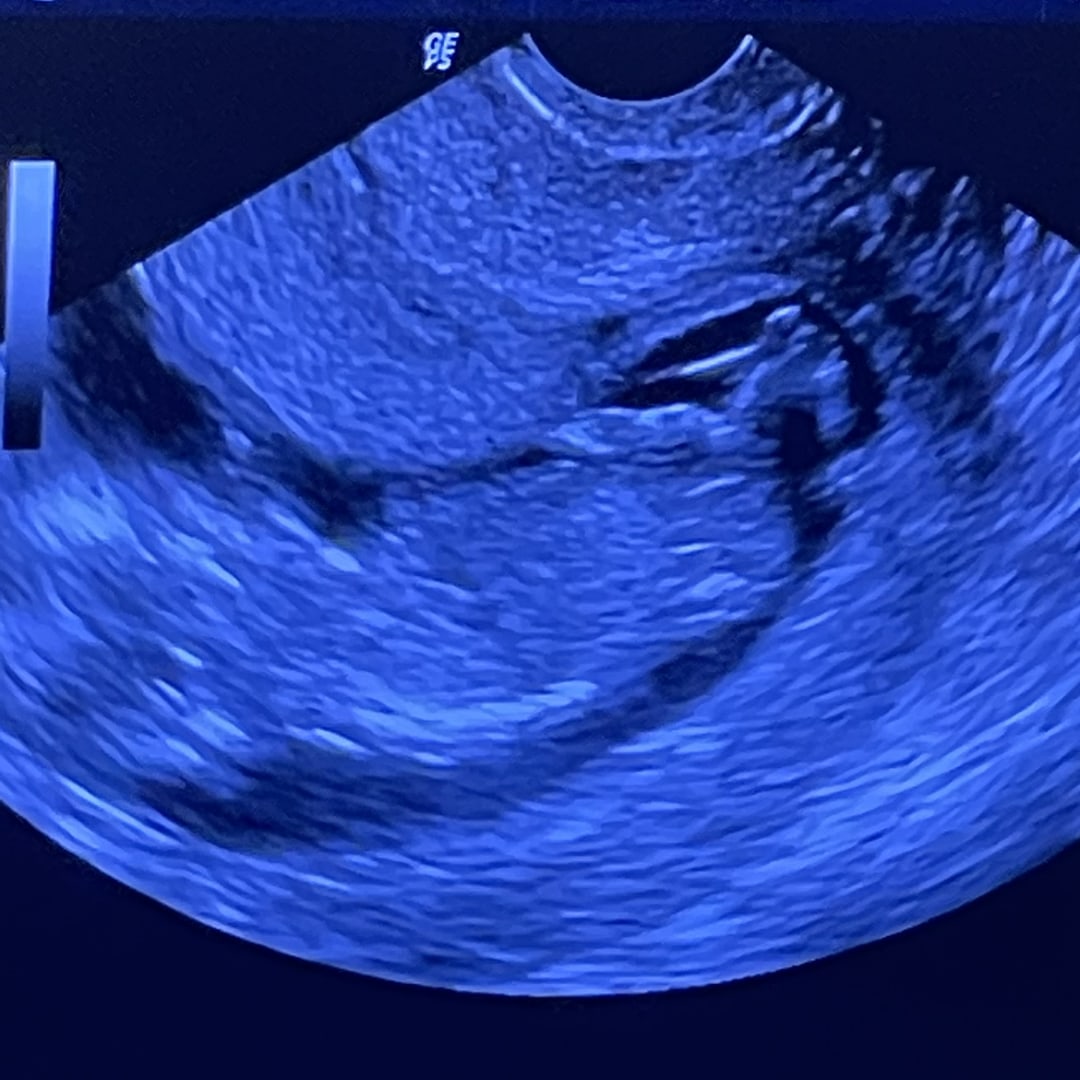 Photo shared by Claudia for their Babylist baby registry.