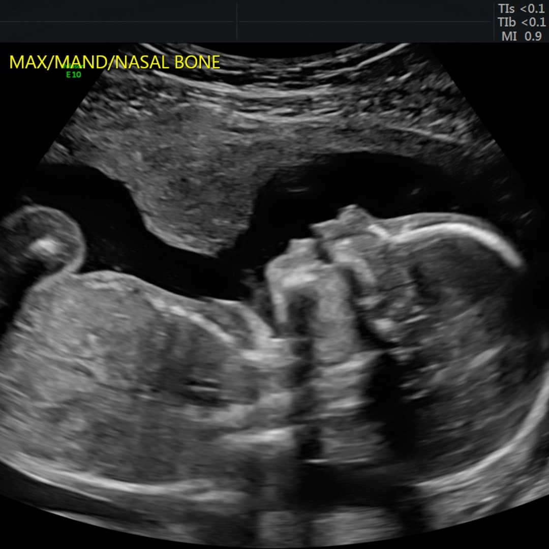 Photo shared by Samantha for their Babylist baby registry.