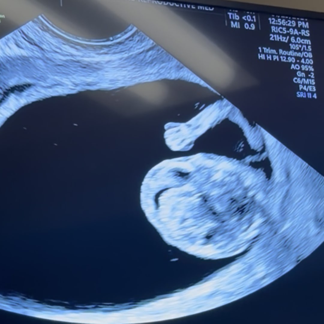 Photo shared by Miranda and Kade for their Babylist baby registry.