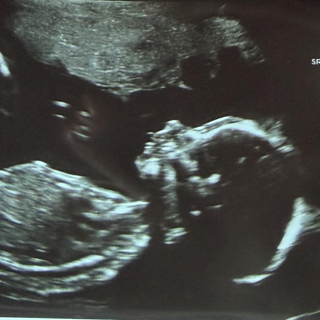 Photo shared by Harlyrae for their Babylist baby registry.