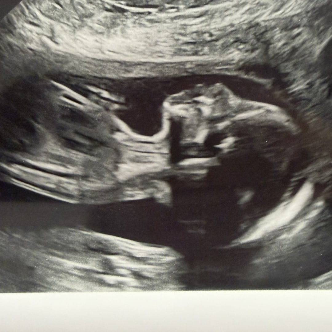 Photo shared by Meagan for their Babylist baby registry.