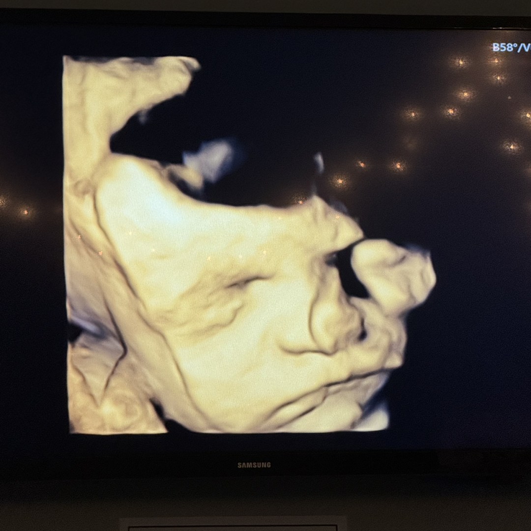 Photo shared by Oakley for their Babylist baby registry.