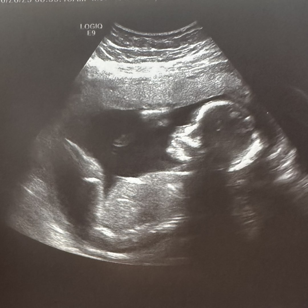 Photo shared by Karen for their Babylist baby registry.