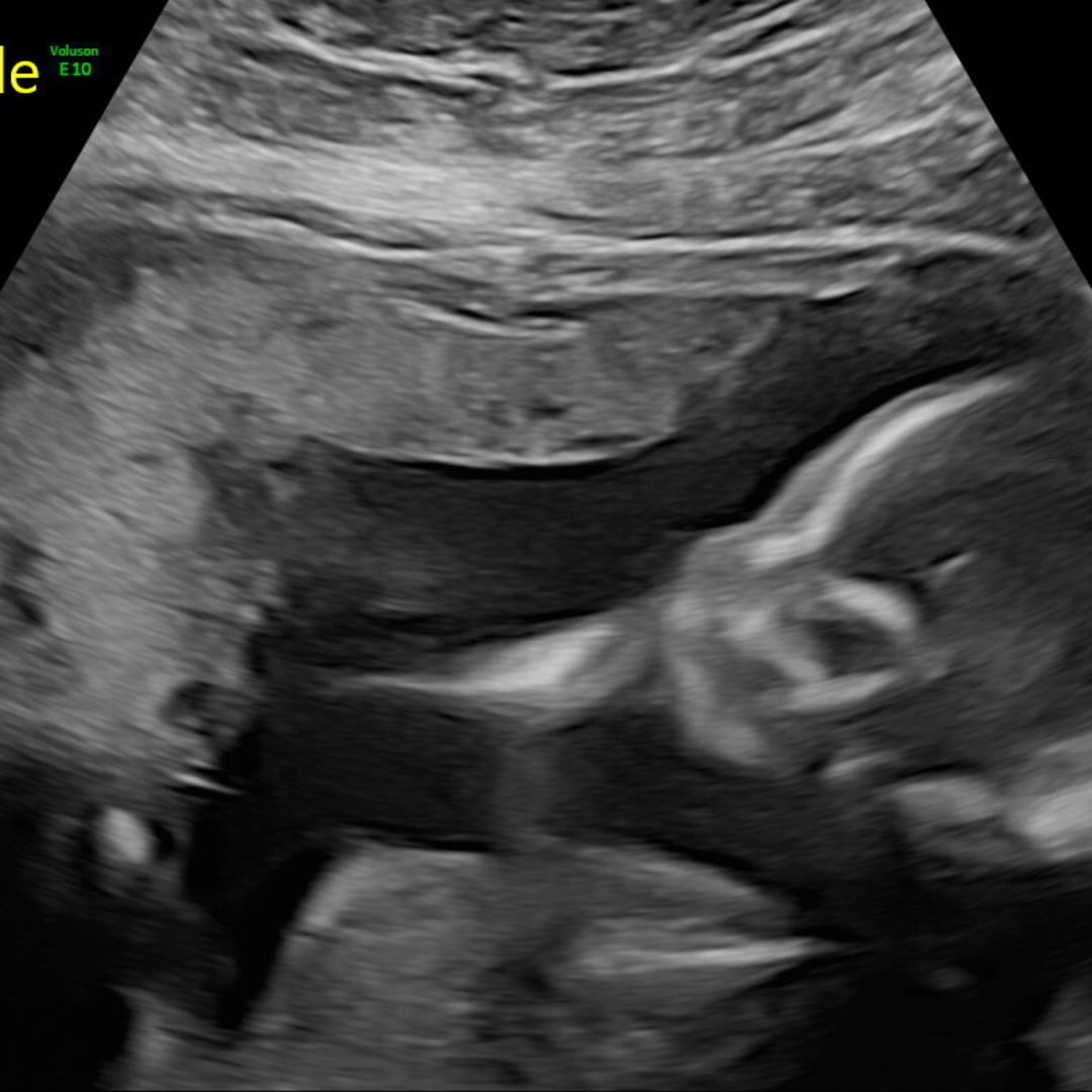 Photo shared by Elva for their Babylist baby registry.