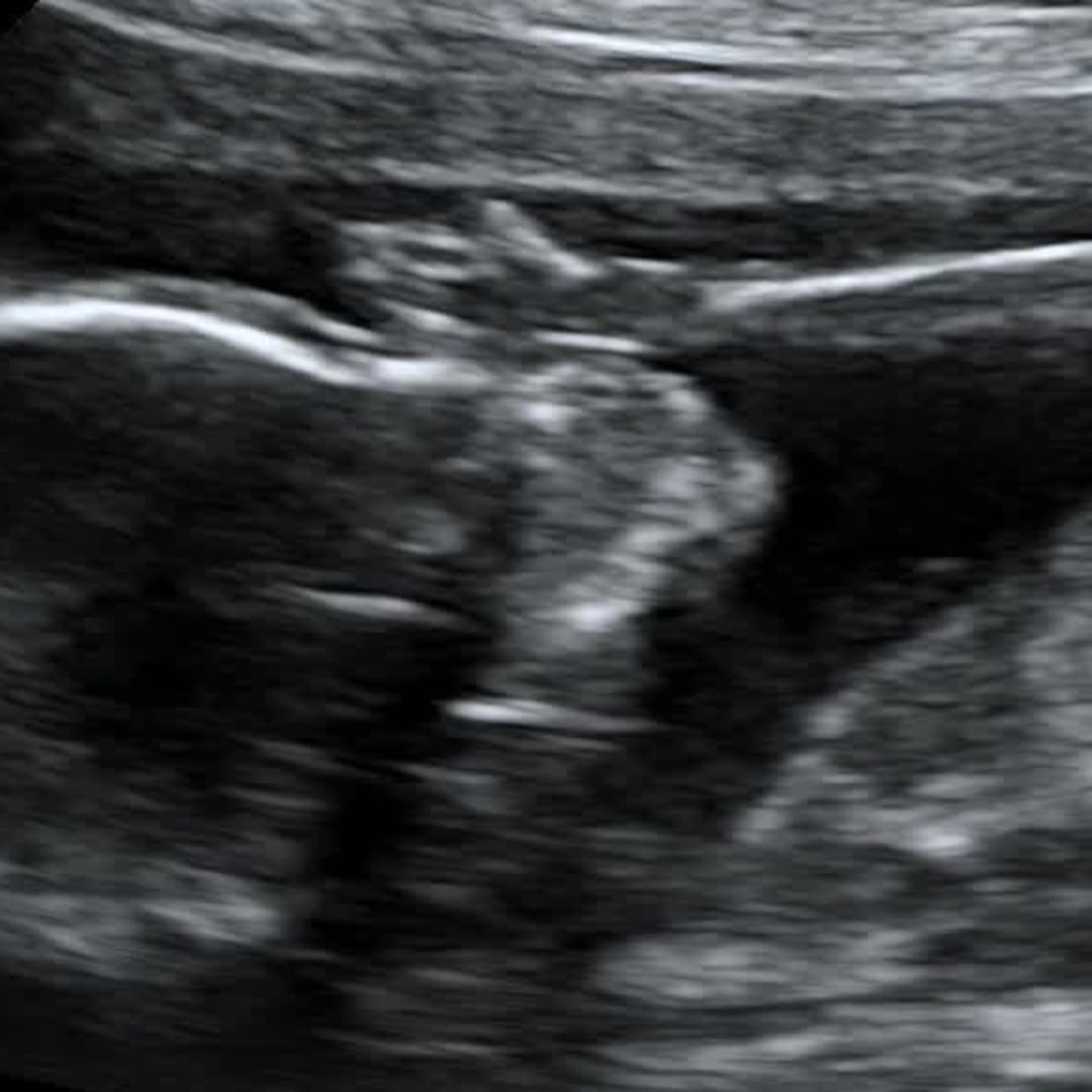 Photo shared by Kayla for their Babylist baby registry.