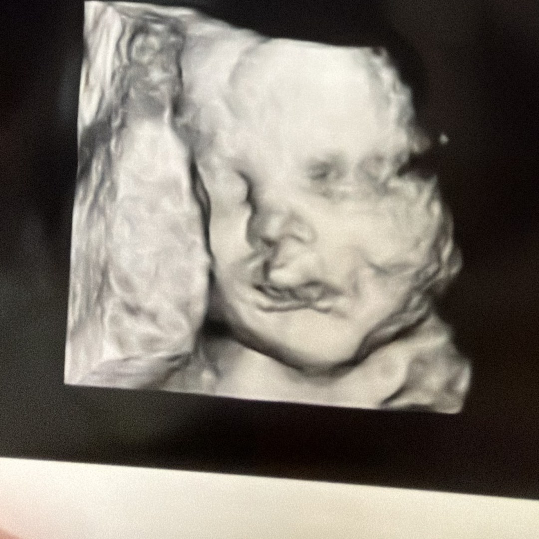 Photo shared by Erin for their Babylist baby registry.