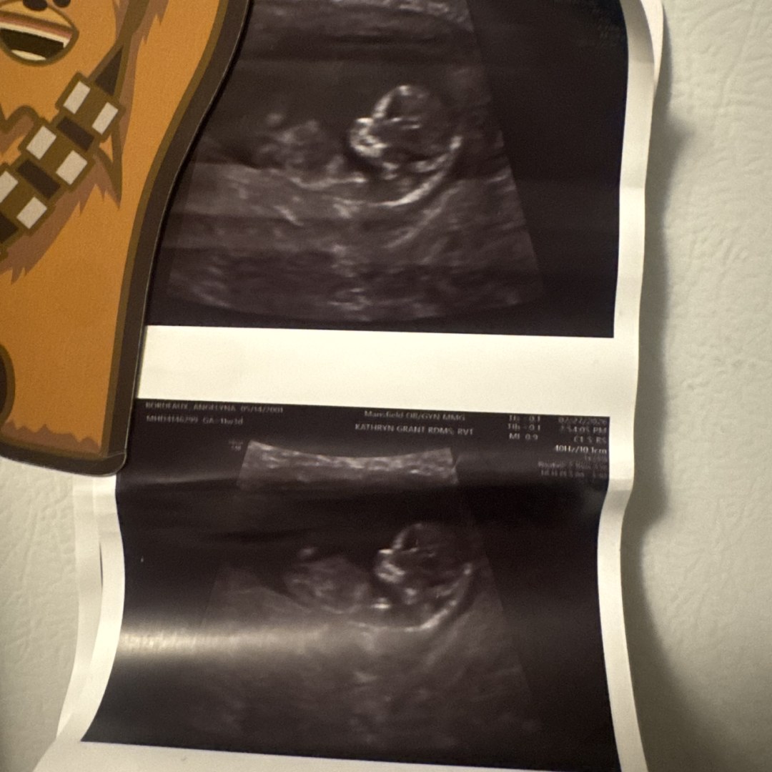 Photo shared by Angelyna for their Babylist baby registry.