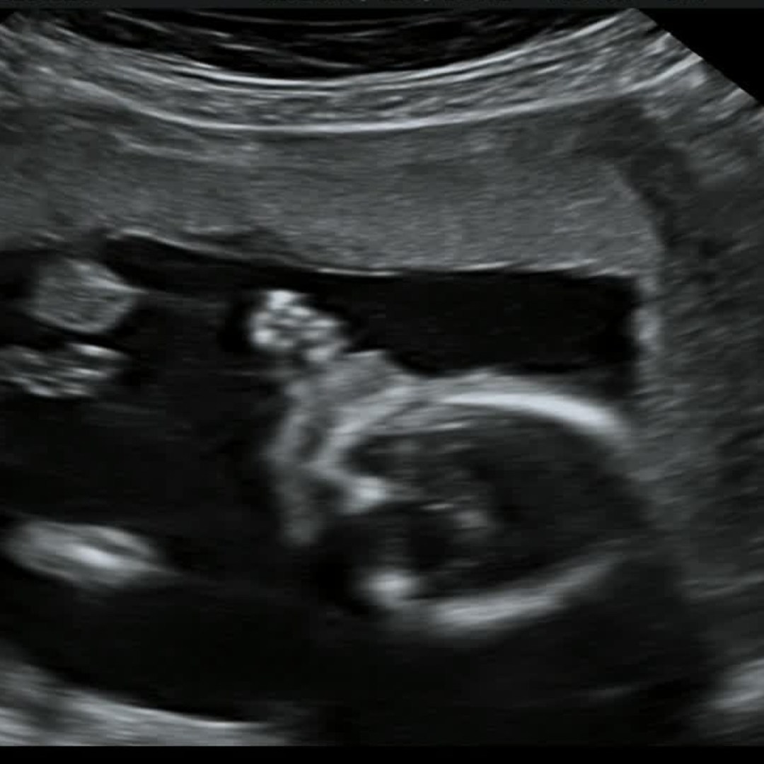 Photo shared by Brianna for their Babylist baby registry.