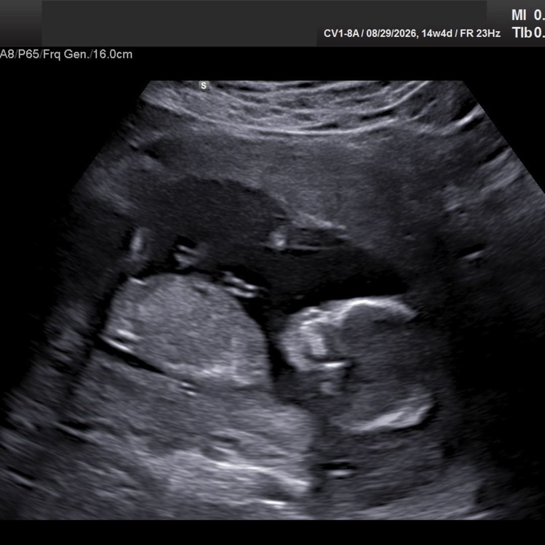 Photo shared by Madison for their Babylist baby registry.