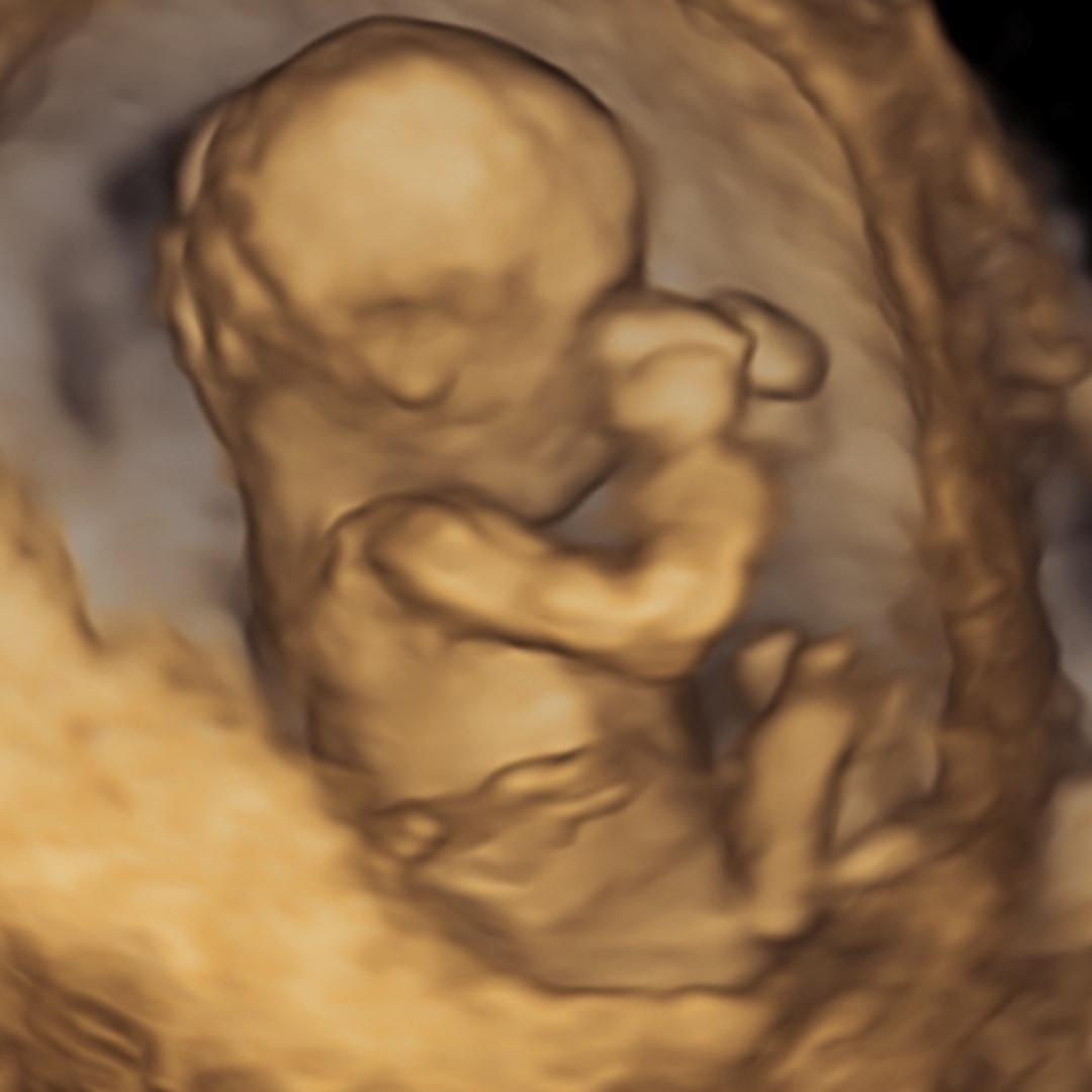 Photo shared by Jesselyn for their Babylist baby registry.