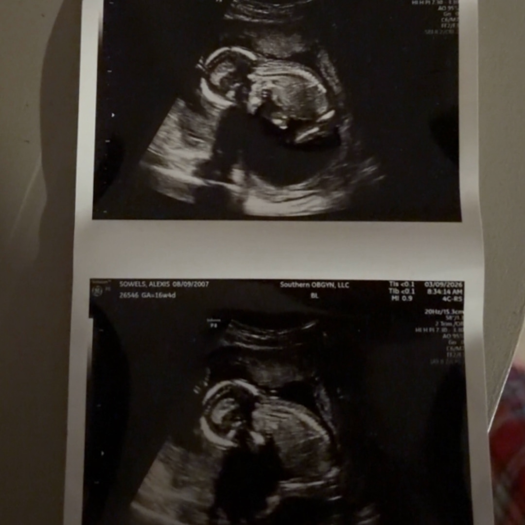 Photo shared by Lexi for their Babylist baby registry.