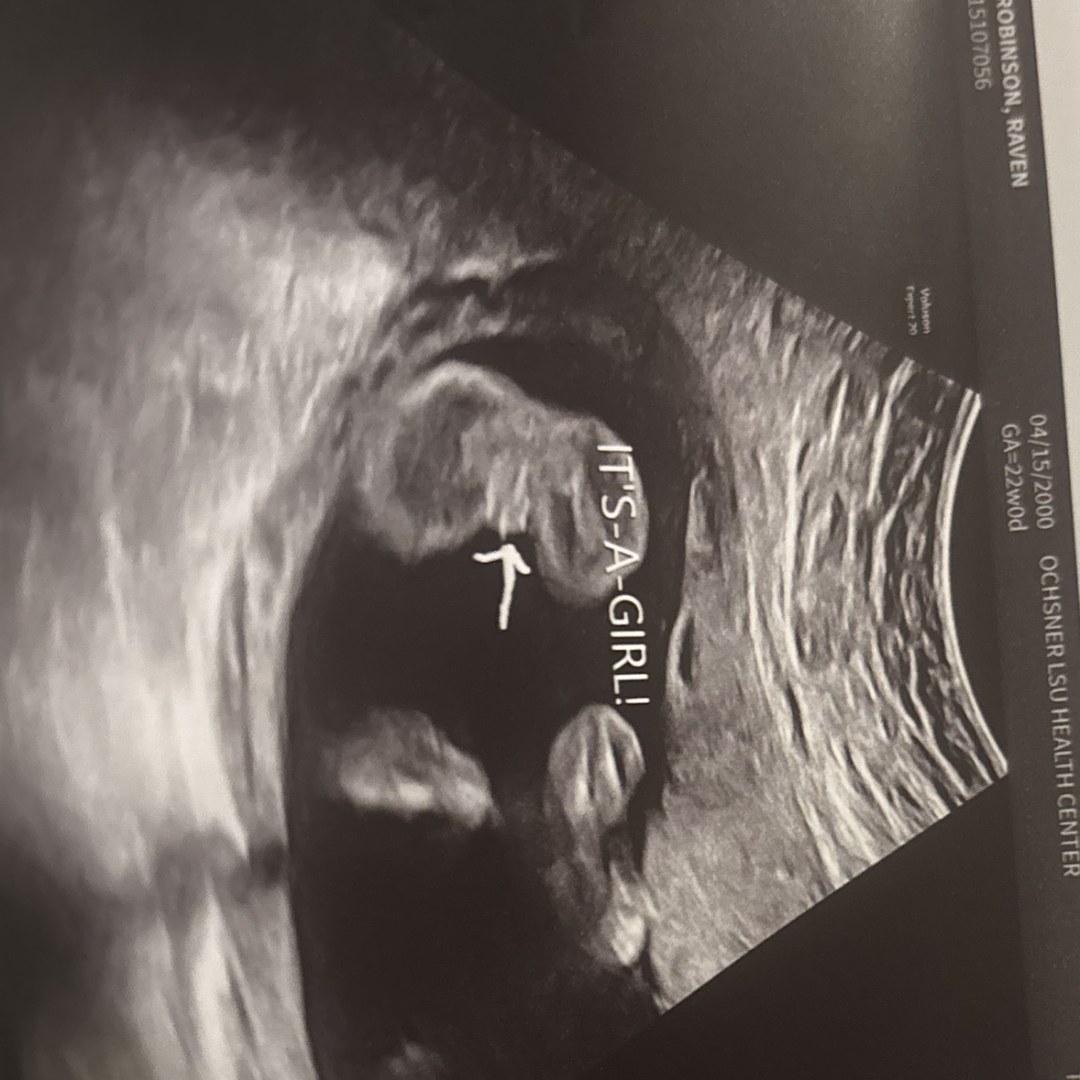 Photo shared by Raven for their Babylist baby registry.