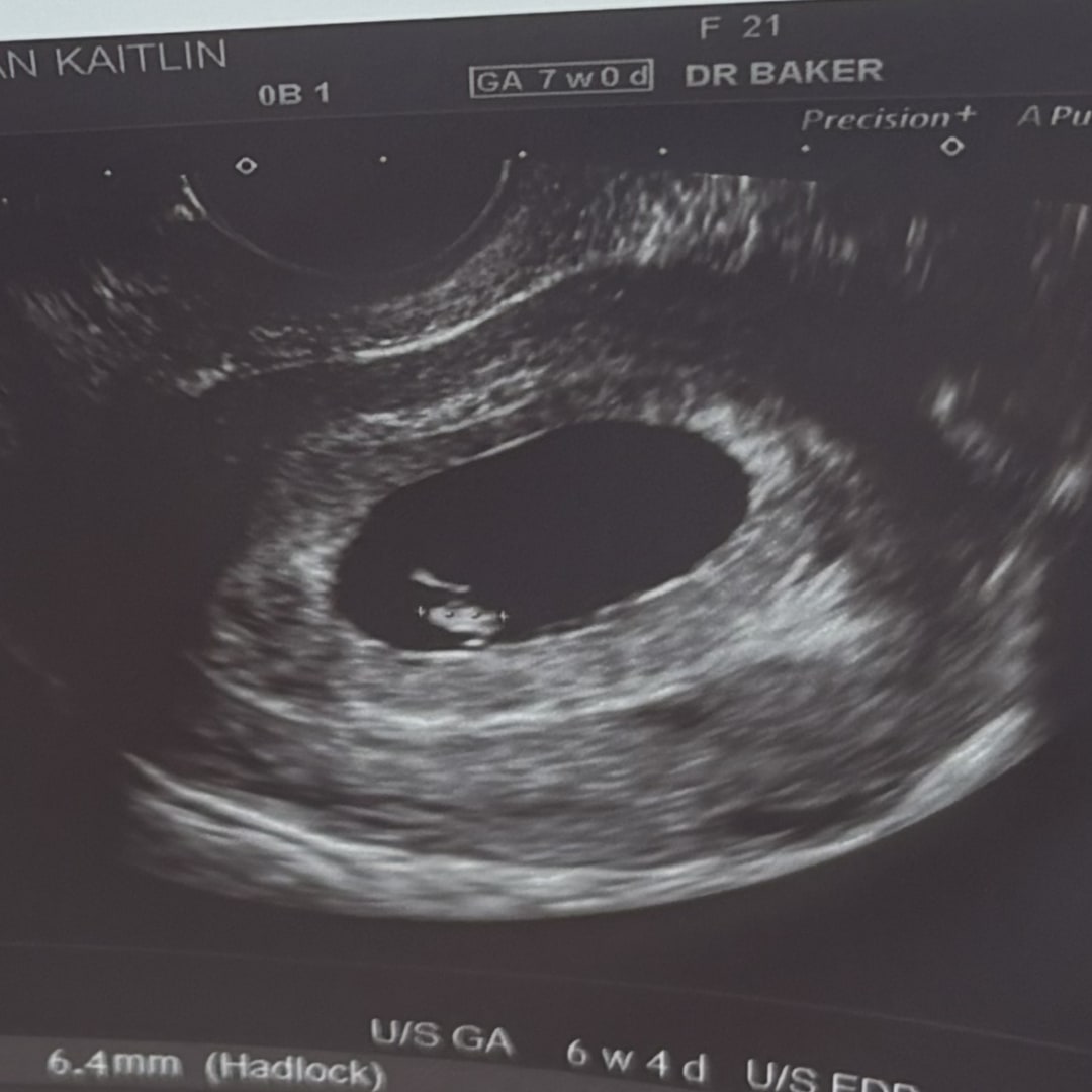 Photo shared by Kaitlin for their Babylist baby registry.