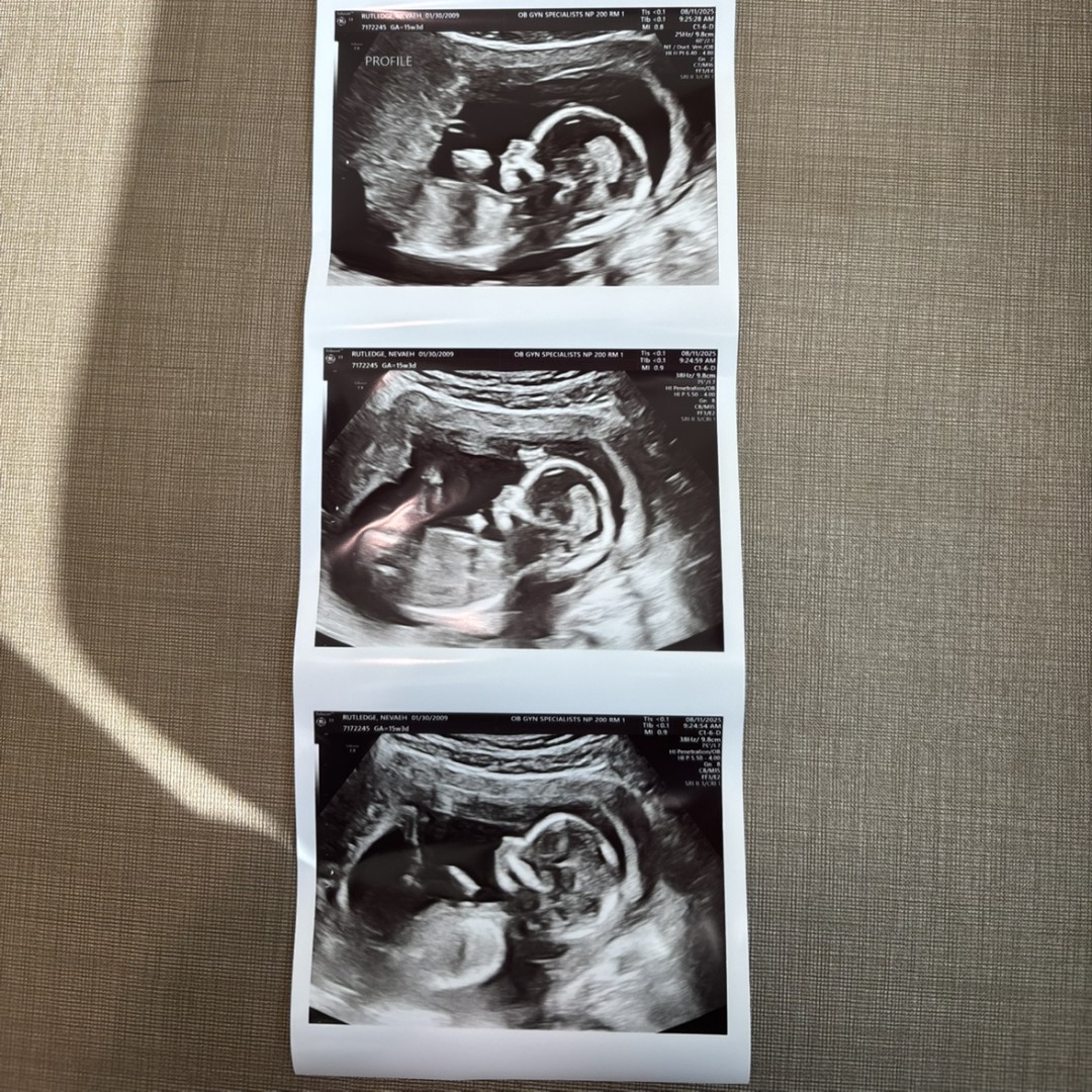 Photo shared by Vae for their Babylist baby registry.