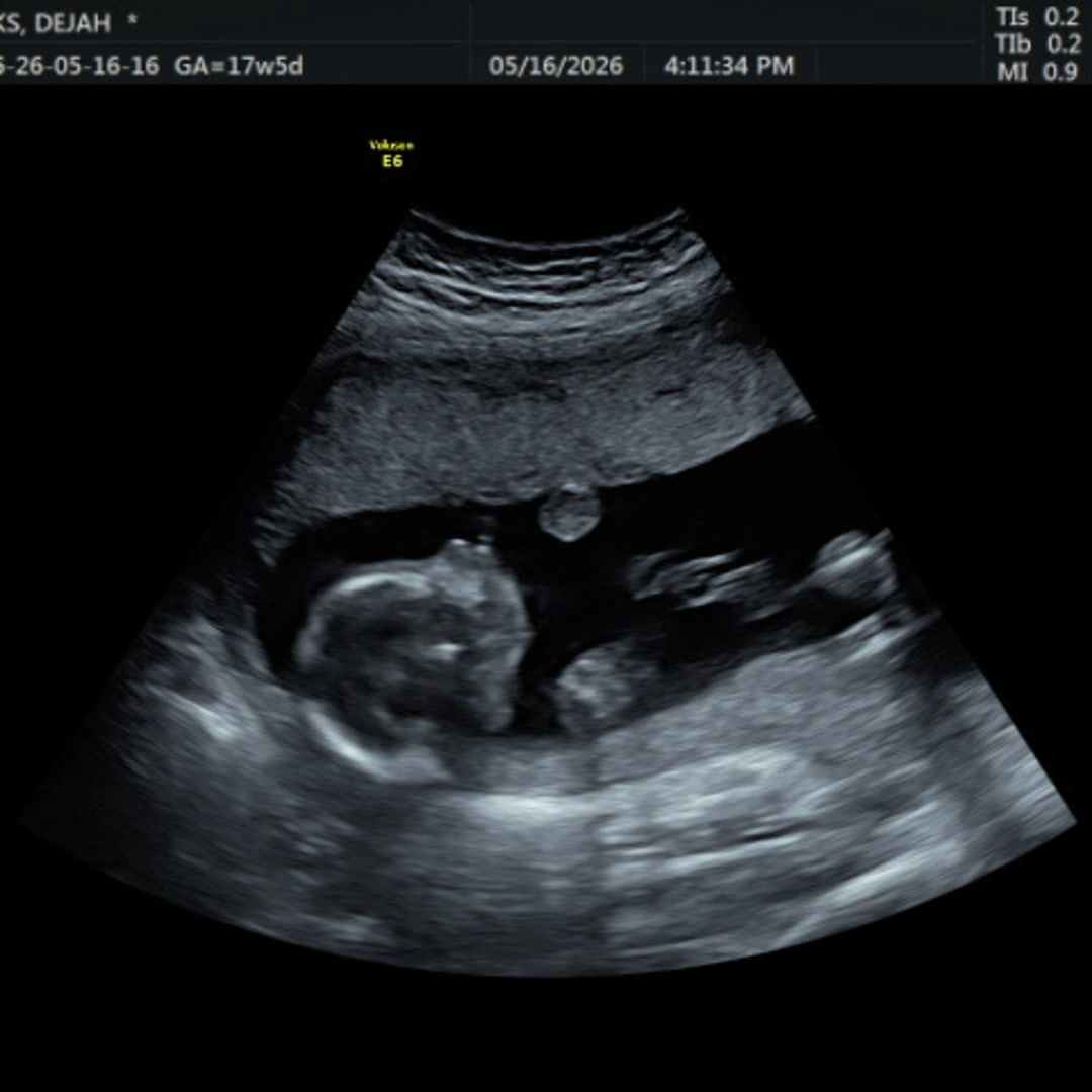 Photo shared by Dejah for their Babylist baby registry.