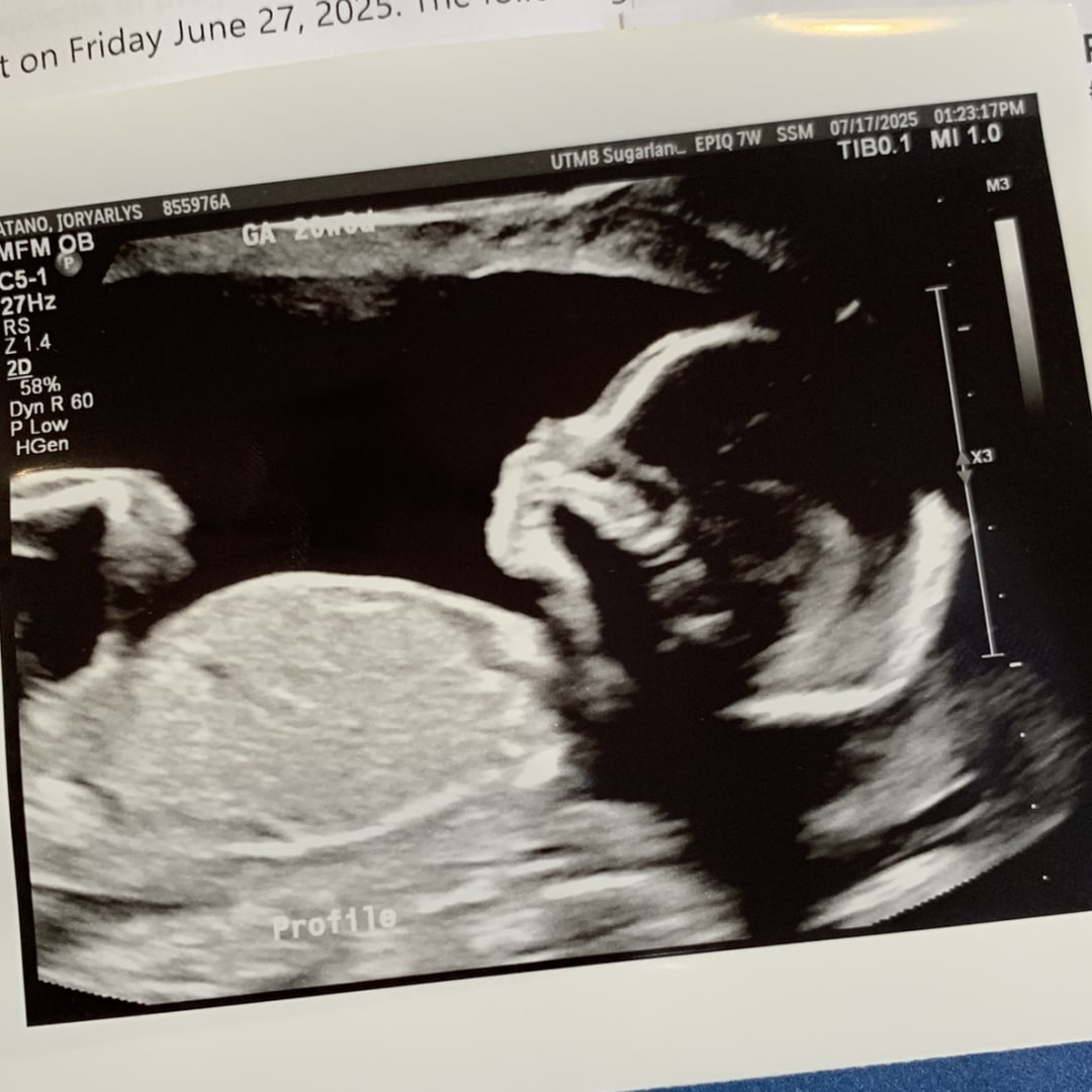 Photo shared by Joryarlys for their Babylist baby registry.
