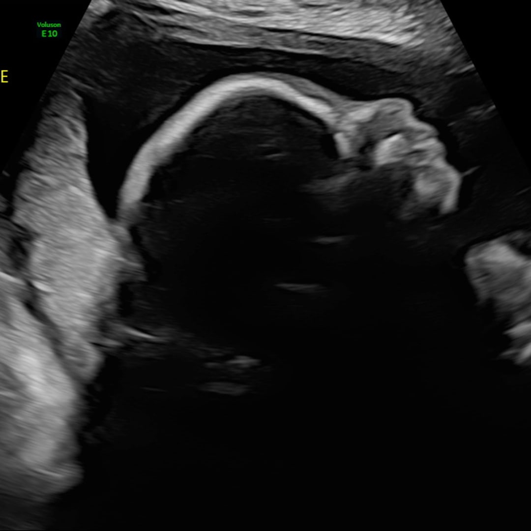 Photo shared by Kortney for their Babylist baby registry.