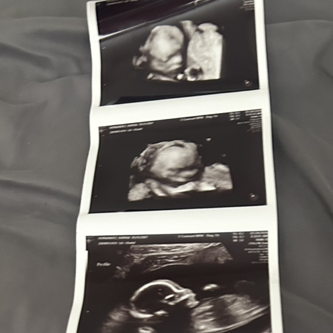 Photo shared by Karina for their Babylist baby registry.