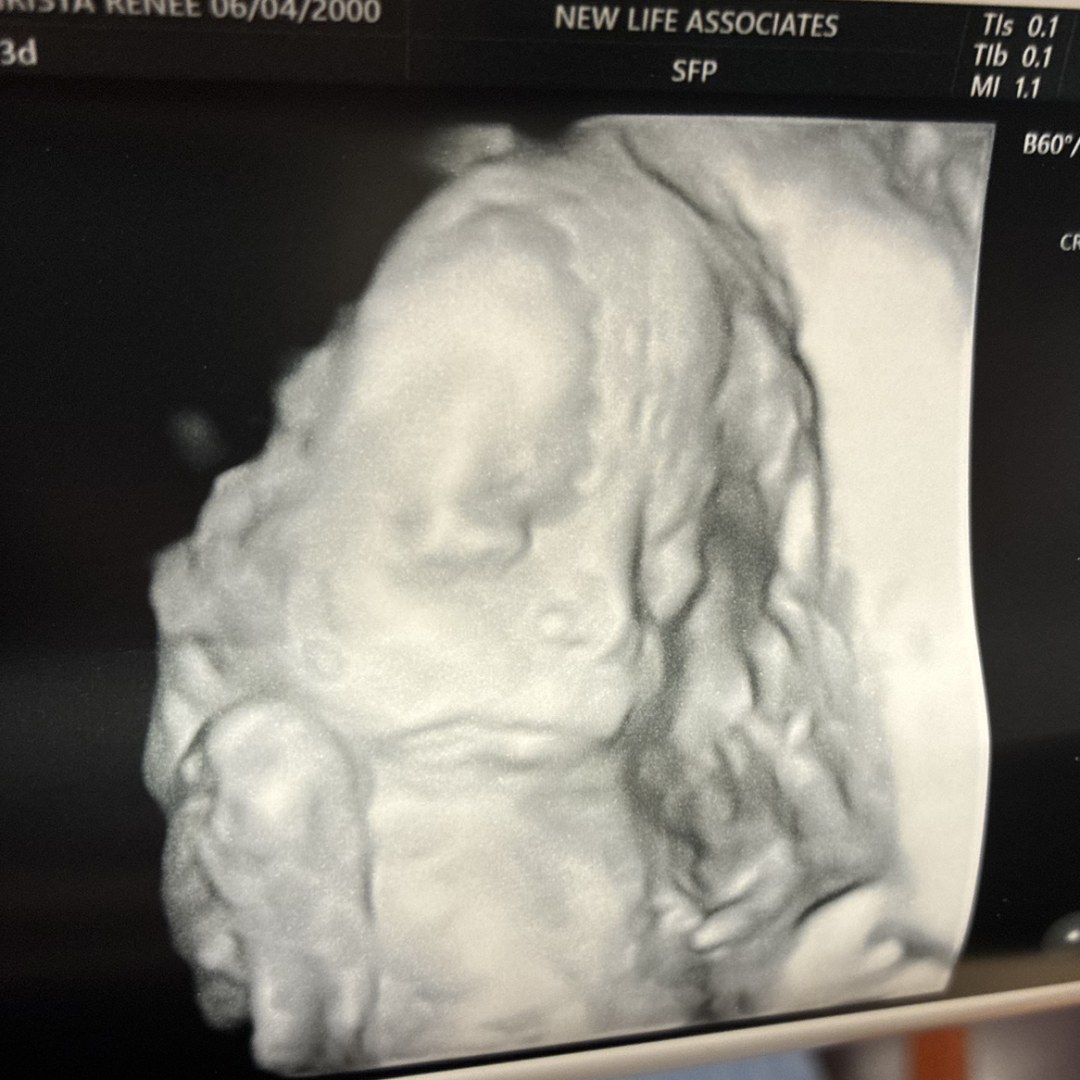 Photo shared by Christa for their Babylist baby registry.