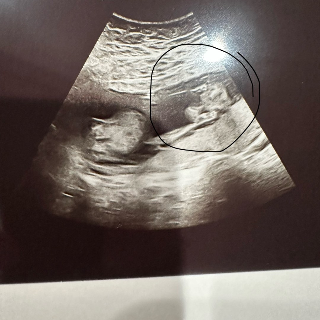 Photo shared by Rachel for their Babylist baby registry.