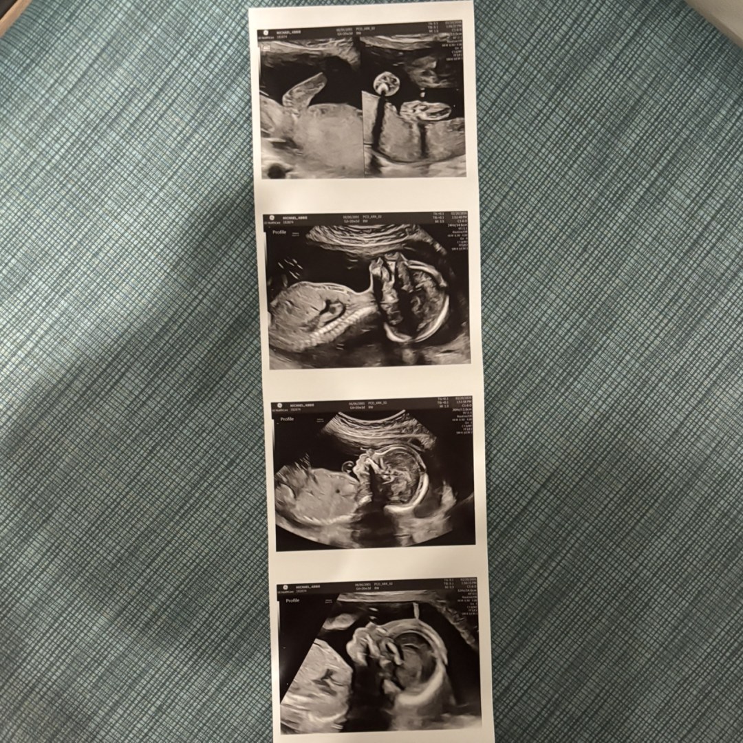 Photo shared by Abbie for their Babylist baby registry.