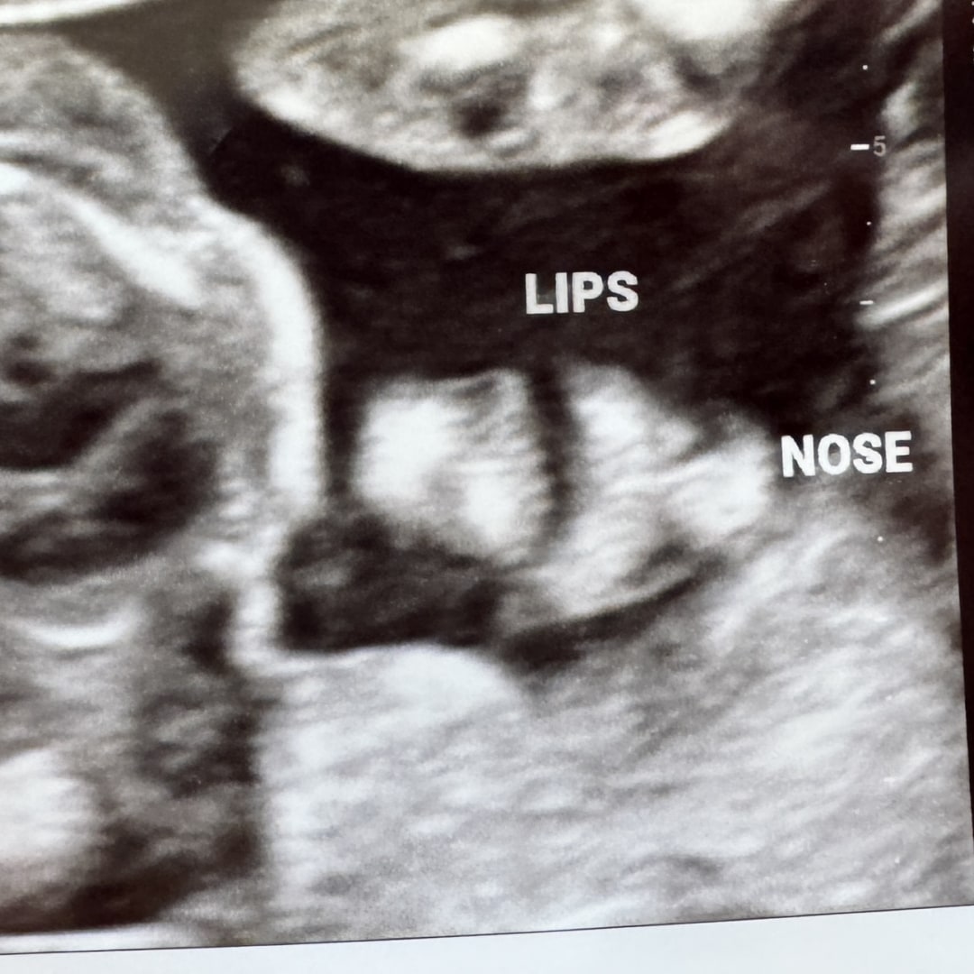 Photo shared by Helena for their Babylist baby registry.