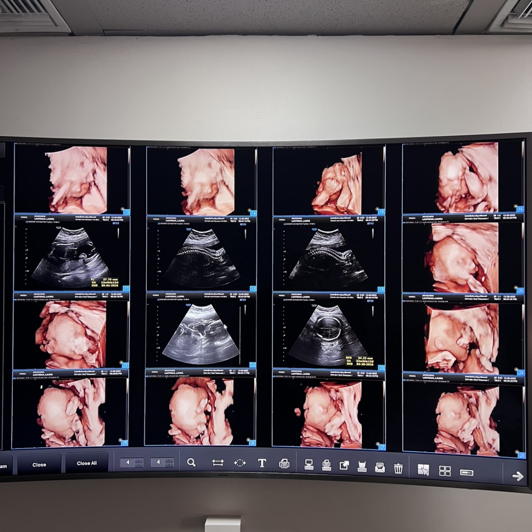 Photo shared by Laura for their Babylist baby registry.