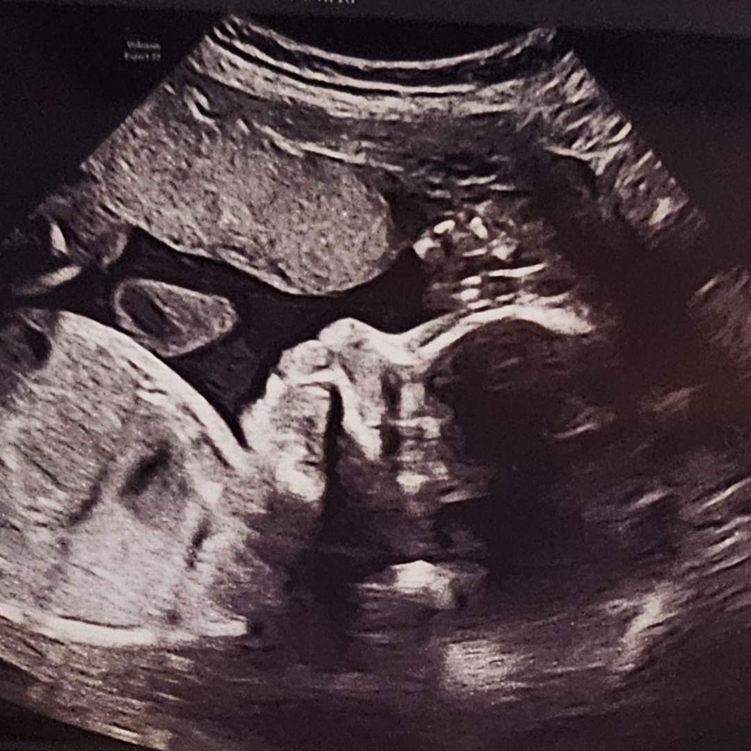 Photo shared by Karla for their Babylist baby registry.