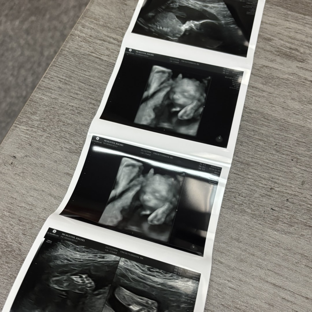 Photo shared by Rachel for their Babylist baby registry.