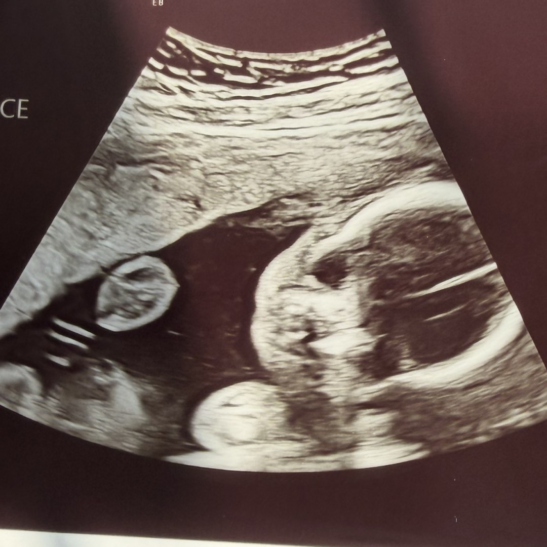Photo shared by Giselle for their Babylist baby registry.