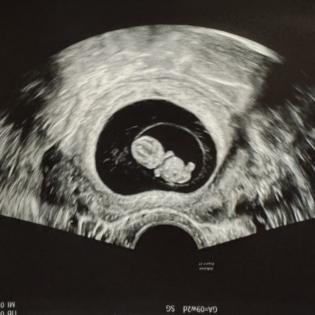 Photo shared by Allie for their Babylist baby registry.