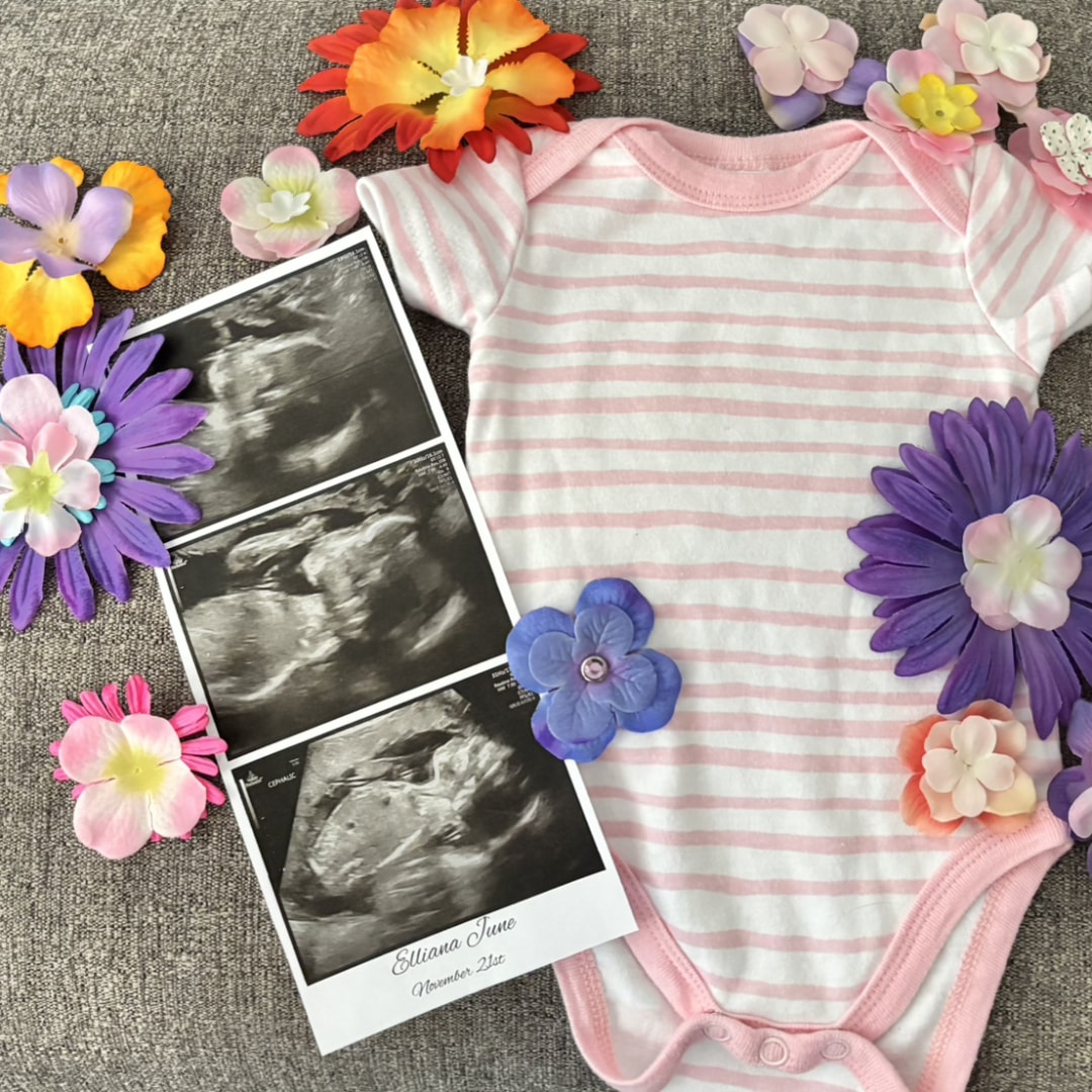 Photo shared by Alexis for their Babylist baby registry.