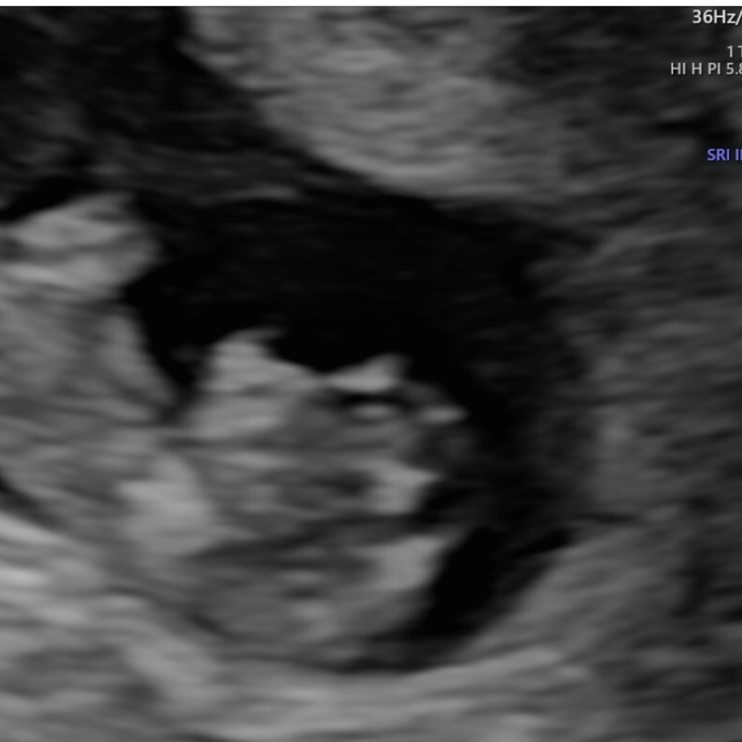 Photo shared by Jadie for their Babylist baby registry.