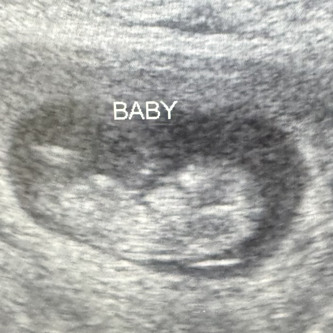 Photo shared by Esteban for their Babylist baby registry.