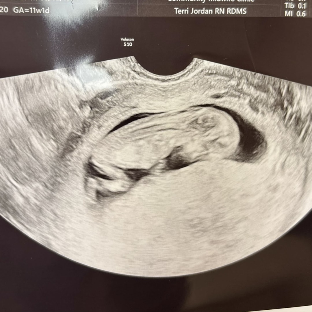 Photo shared by Ashley for their Babylist baby registry.