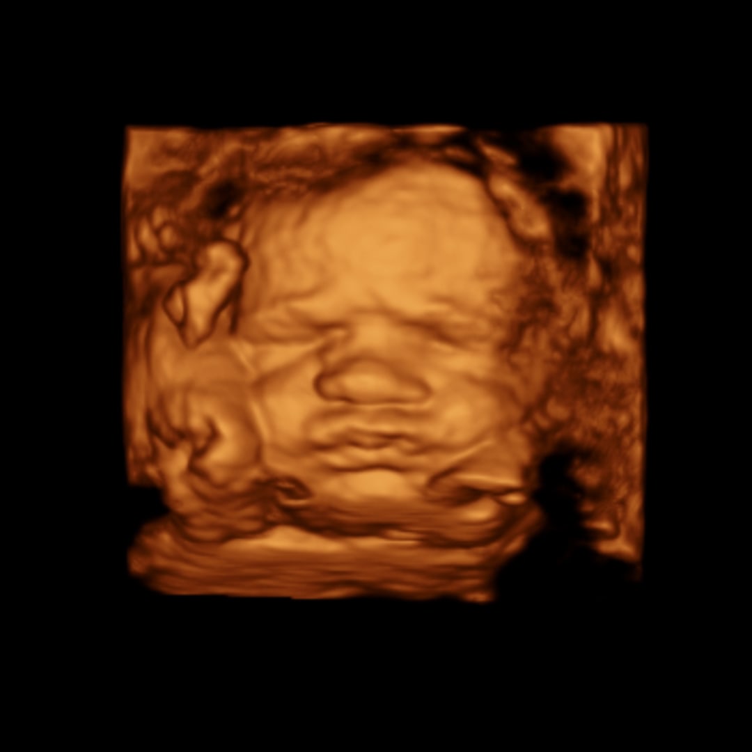Photo shared by Dawson for their Babylist baby registry.